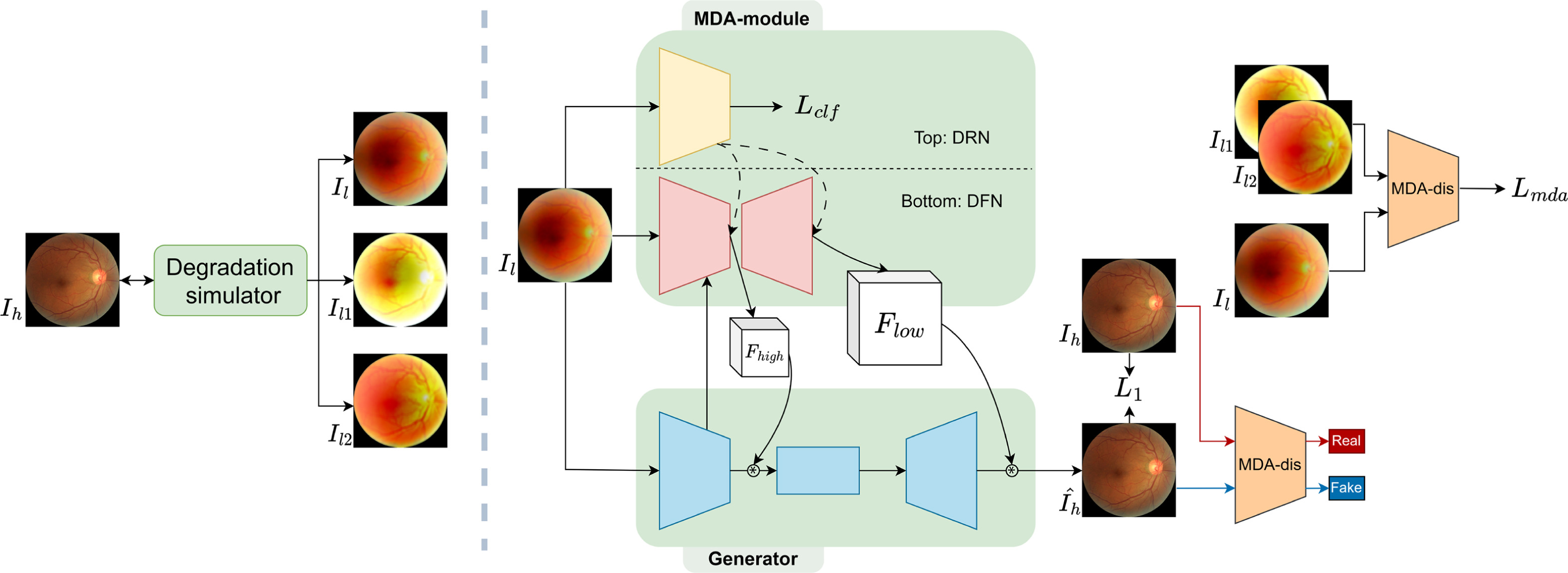 Multi-Degradation-Adaptation Network for Fundus Image Enhancement with Degradation Representation Learning