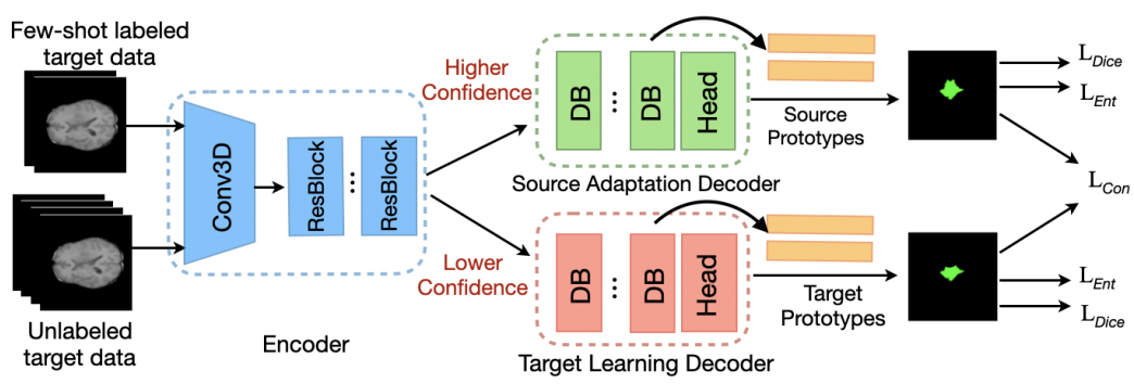 Source-free Few-shot Segmentation for Rarer Brain Tumors